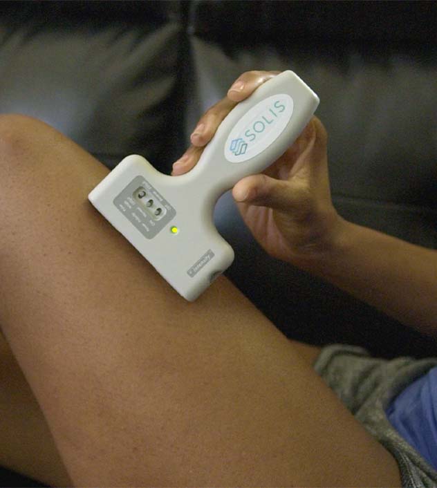 A person using the SOLIS Pain Relief System on their thigh